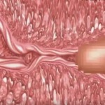 Thumbnail of post image 012