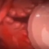 Thumbnail of related posts 154