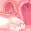 Thumbnail of related posts 045