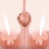 Thumbnail of related posts 189